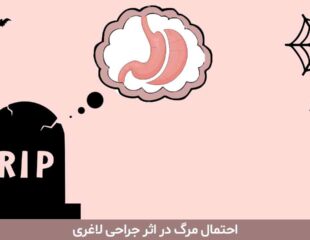 احتمال مرگ در اثر جراحی لاغری