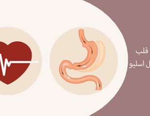 تپش بالا قلب بعد از عمل اسلیو
