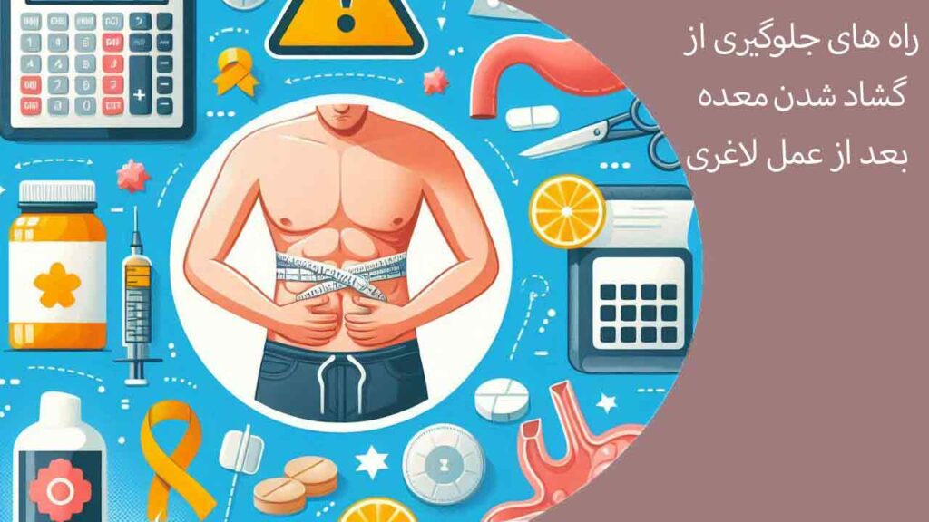 راه های جلوگیری از گشاد شدن معده بعد از عمل لاغری