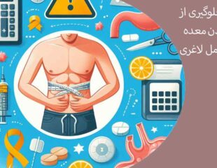 راه های جلوگیری از گشاد شدن معده بعد از عمل لاغری